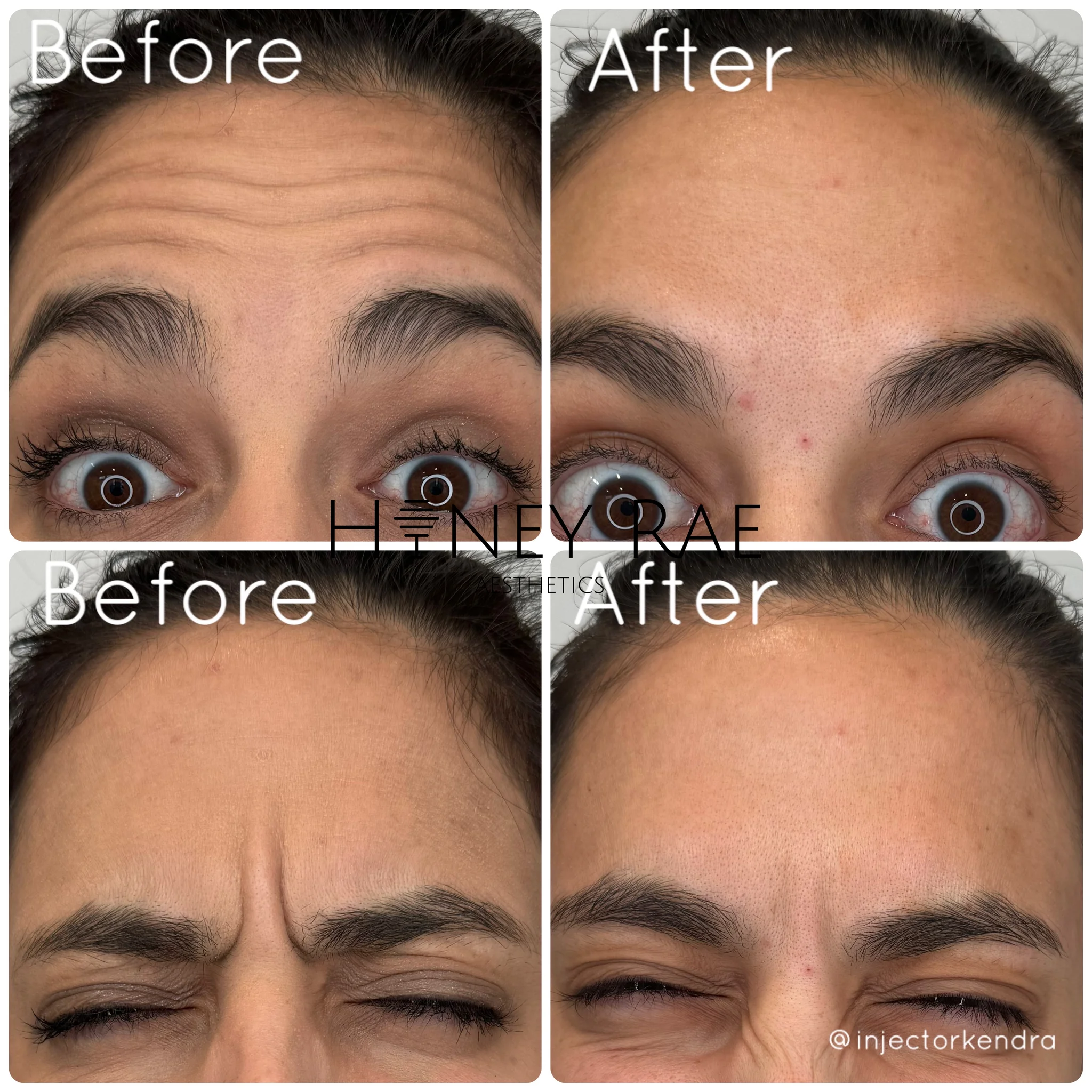 Before and after treatment reveal