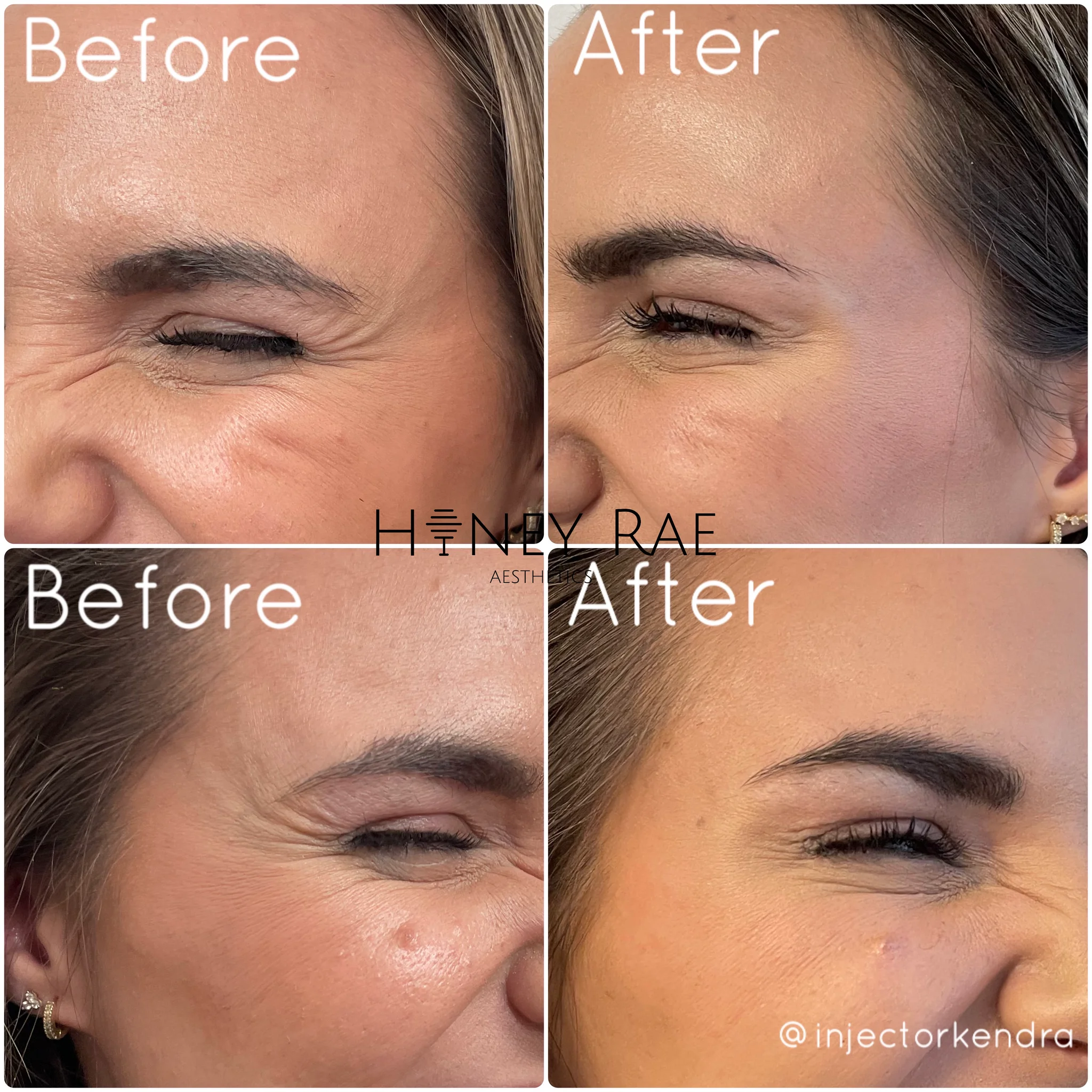 Aesthetic enhancement transformation video