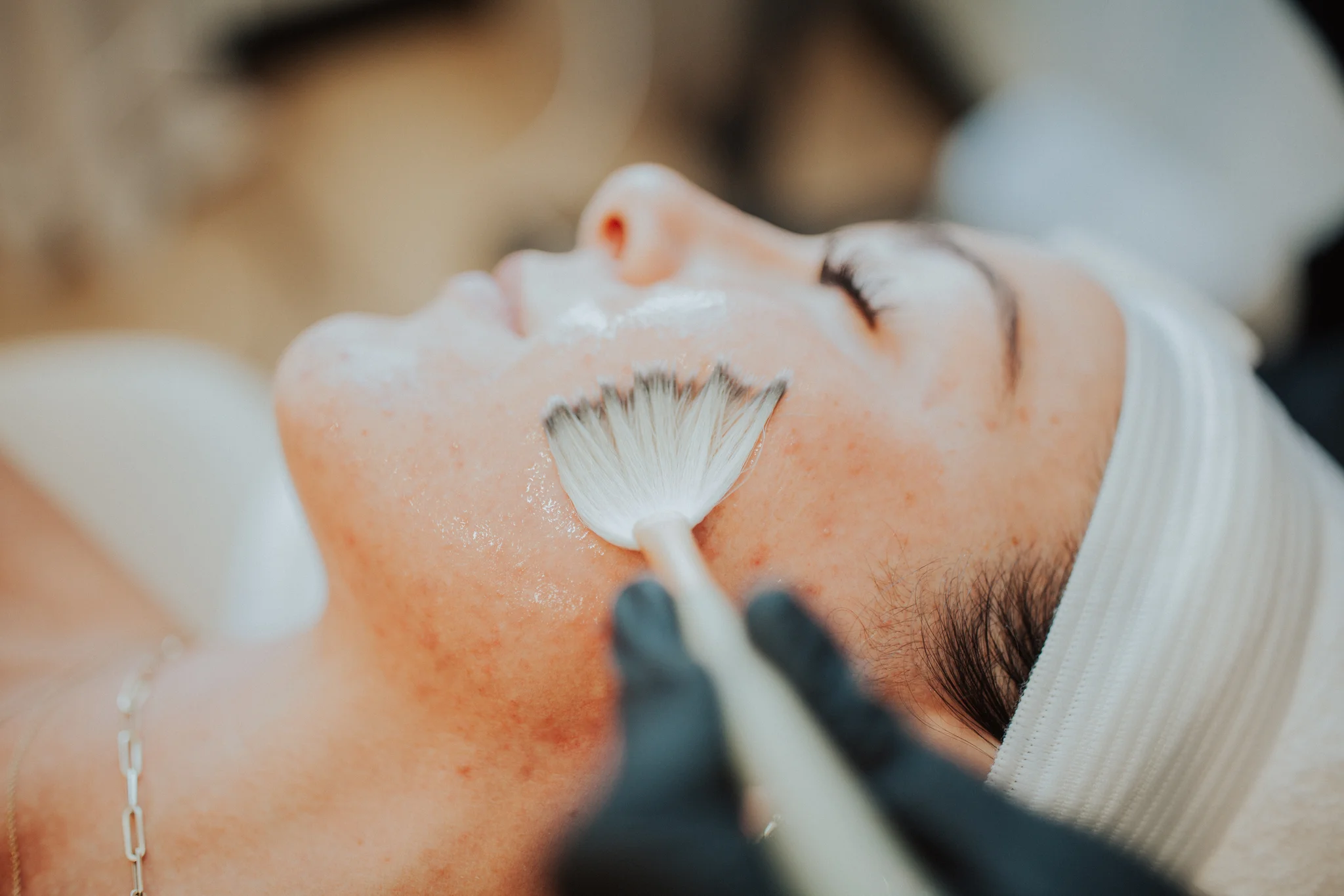 Acne Bootcamp treatment at Honey Rae Aesthetics