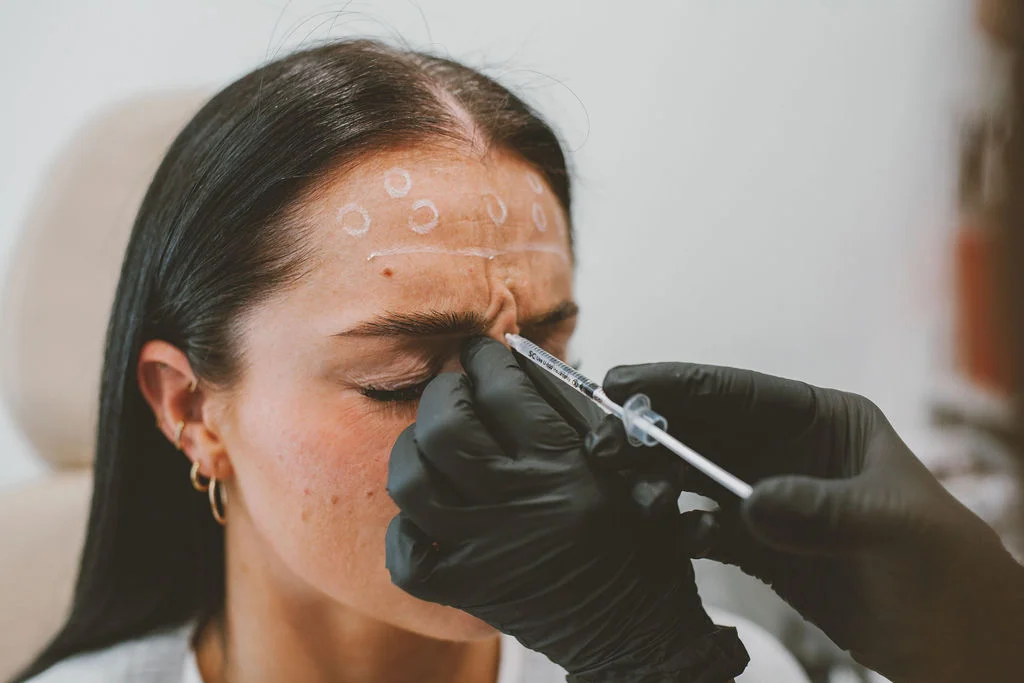 Neurotoxin treatment at Honey Rae Aesthetics