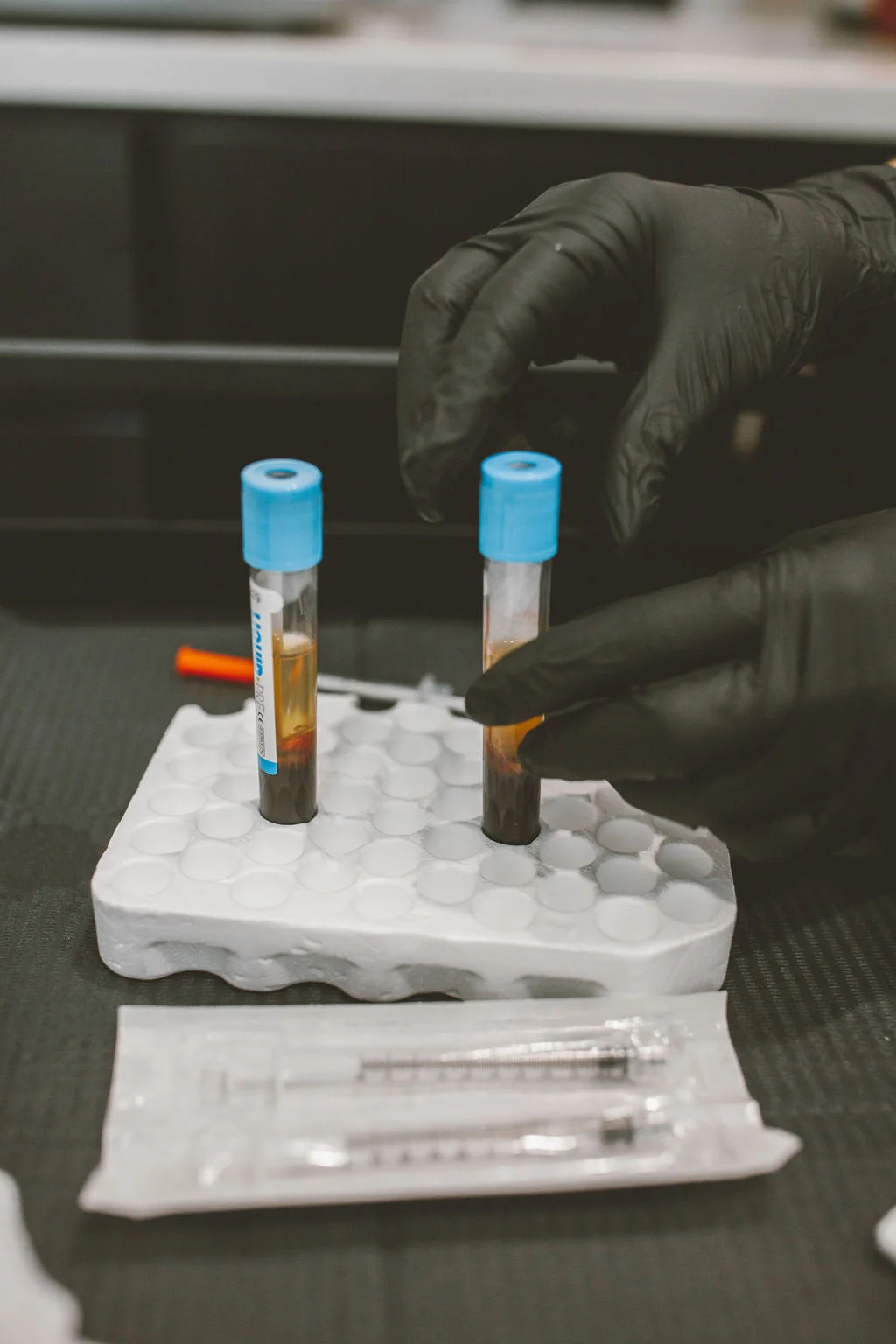 Biostimulators / Sculptra treatment